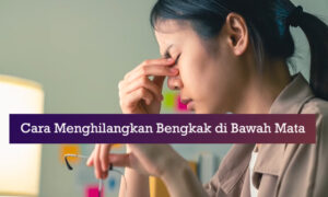 cara menghilangkan bengkak di bawah mata